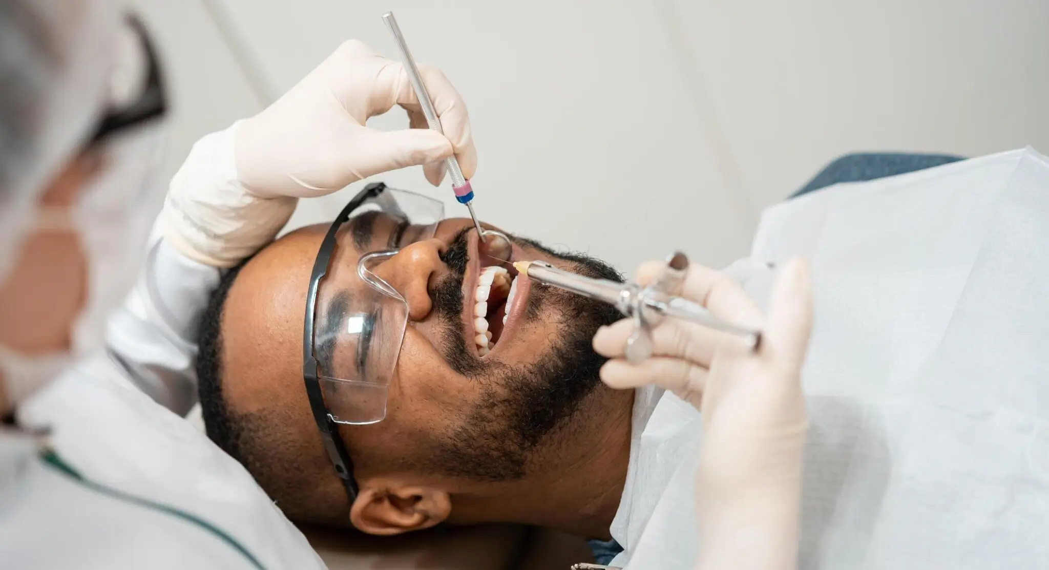 Root Canal Treatment