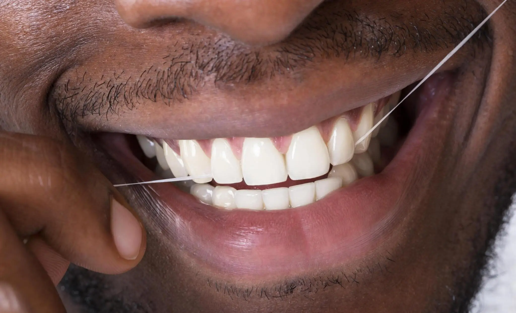 Dental Scaling